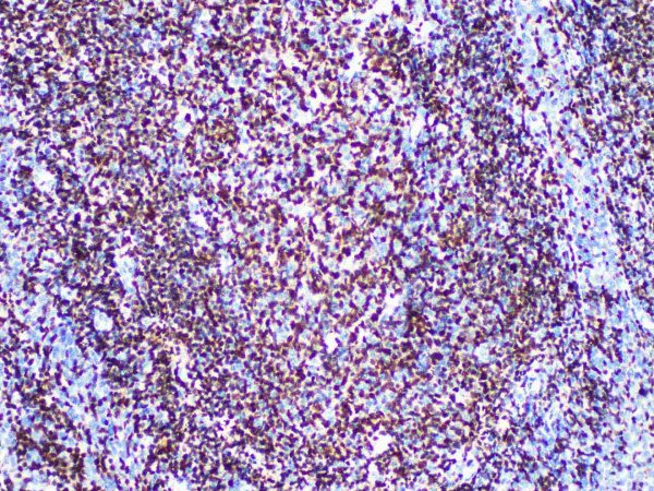 OCT2 Monoclonal Antibody (ELAB6141-M)