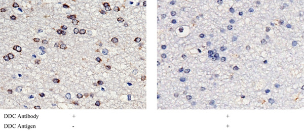 Recombinant DOPA Decarboxylase/DDC Monoclonal Antibody (AN300344P)