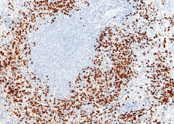 Recombinant S100A9 Monoclonal Antibody (AN300082P)