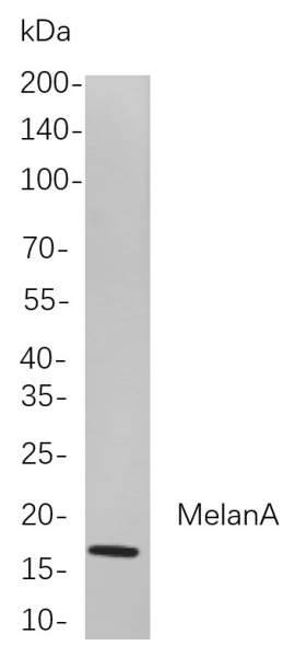 Recombinant MelanA Monoclonal Antibody (AN300916L)