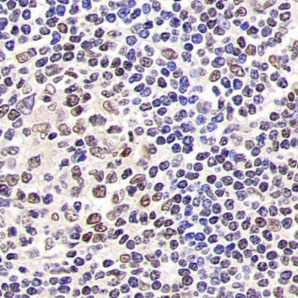 SIRT1 Polyclonal Antibody (E-AB-70071)