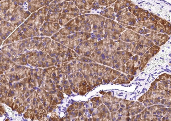 Recombinant Carboxypeptidase A2/CPA2 Monoclonal Antibody (AN300559P)