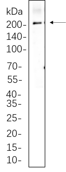 Recombinant LRP6 Monoclonal Antibody (AN300719L)