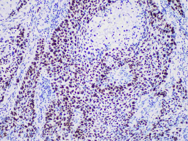p40 Monoclonal Antibody (ELAB6665-R)