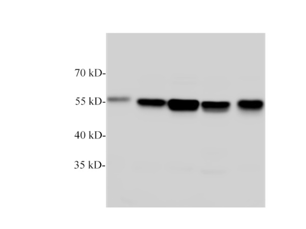 beta Tubulin Polyclonal Antibody (E-AB-40518)