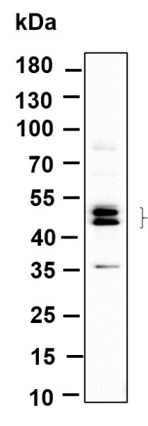 Recombinant Phospho-JNK1, 2, 3 (Thr183, Thr183, Thr221) Monoclonal Antibody (AN301149L)