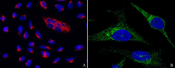 Recombinant PTP1B/PTPN1 Monoclonal Antibody (AN300316P)