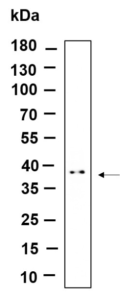 Recombinant STML2 Monoclonal Antibody (AN301155L)