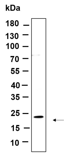 Recombinant Cofilin Monoclonal Antibody (AN301117L)
