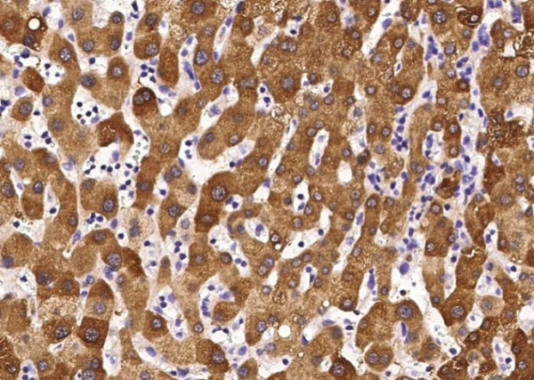 GOT2 Monoclonal Antibody (AN200071P)