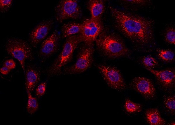 Recombinant Cathepsin D/CTSD Monoclonal Antibody (AN300422P)