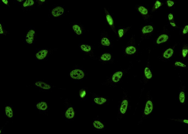 Recombinant DPY30 domain containing 2/DYDC2 Monoclonal Antibody (AN300445P)