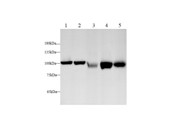 EEF2 Polyclonal Antibody (D-AB-10182L)