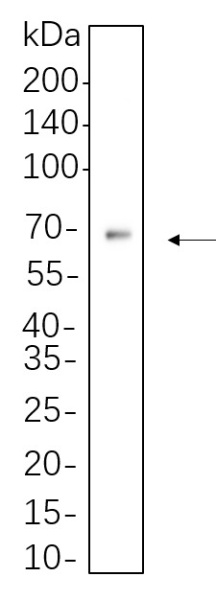 Recombinant AFP Monoclonal Antibody (AN301318L)