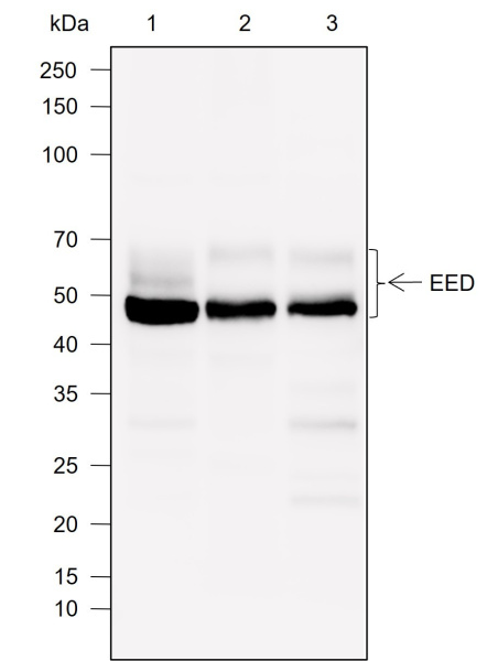 Recombinant EED Monoclonal Antibody (AN302035L)