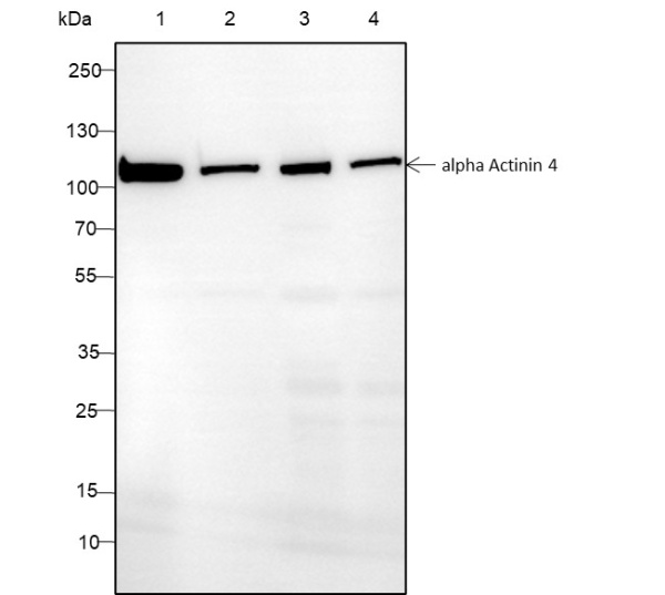 Recombinant alpha Actinin 4 Monoclonal Antibody (AN301433L)