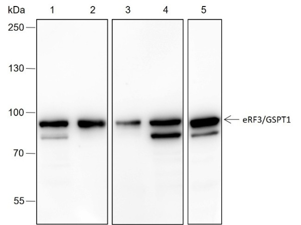 Recombinant eRF3/GSPT1 Monoclonal Antibody (AN301511L)