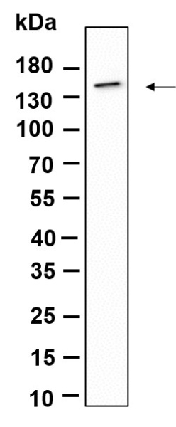 Recombinant CD11c Monoclonal Antibody (AN301173L)