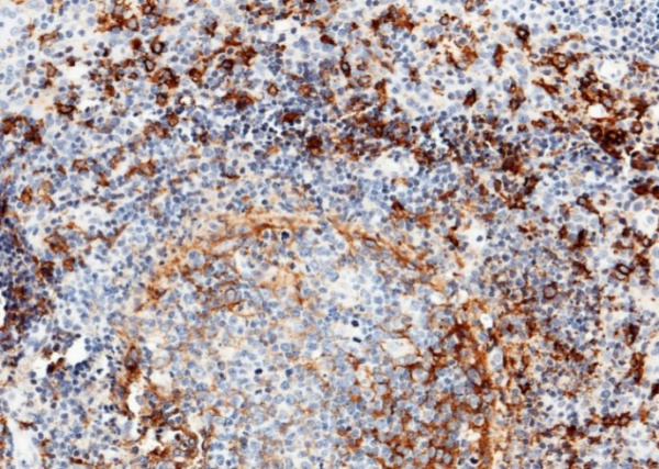 Recombinant CD14 Monoclonal Antibody (AN300175P)