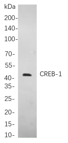 Recombinant CREB-1 Monoclonal Antibody (AN300865L)