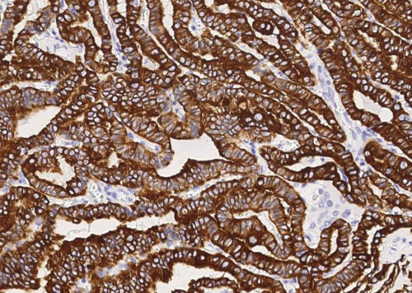 KRT19 Monoclonal Antibody (AN200159P)