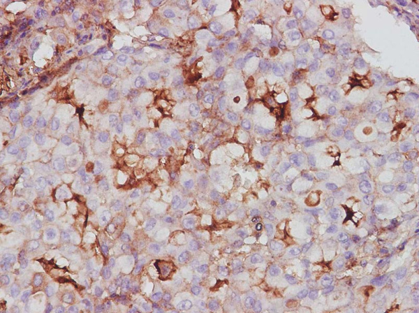 ESM1 Polyclonal Antibody (AN006090L)