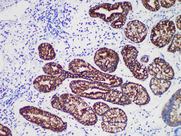 MUC6 Monoclonal Antibody (ELAB6200-M)