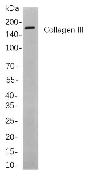 Recombinant Collagen III Monoclonal Antibody (AN301094L)