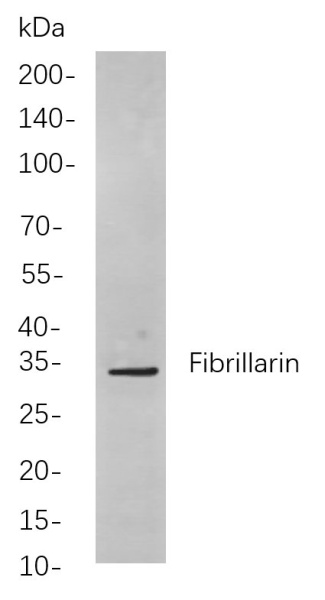 Recombinant Fibrillarin Monoclonal Antibody (AN301071L)