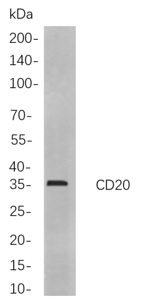 Recombinant CD20 Monoclonal Antibody (AN300908L)