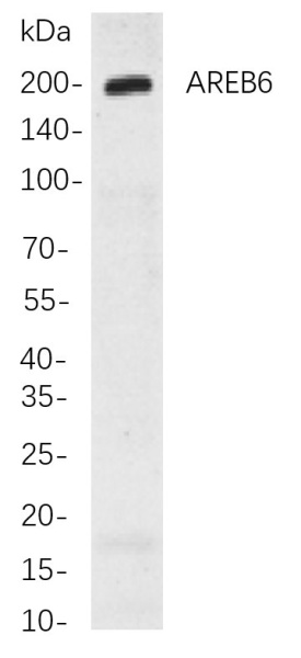 Recombinant AREB6 Monoclonal Antibody (AN301025L)