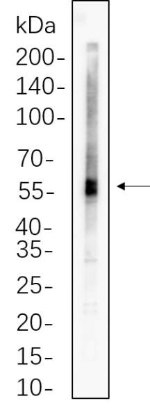 Recombinant ATGL Monoclonal Antibody (AN300803L)