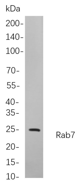 Recombinant Rab7 Monoclonal Antibody (AN300981L)