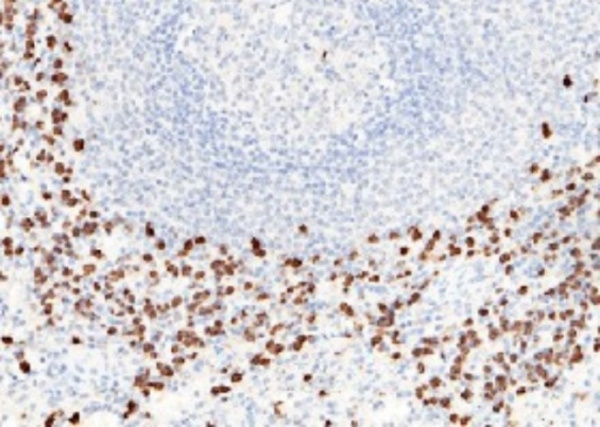 Recombinant S100A8 Monoclonal Antibody (AN300035P)