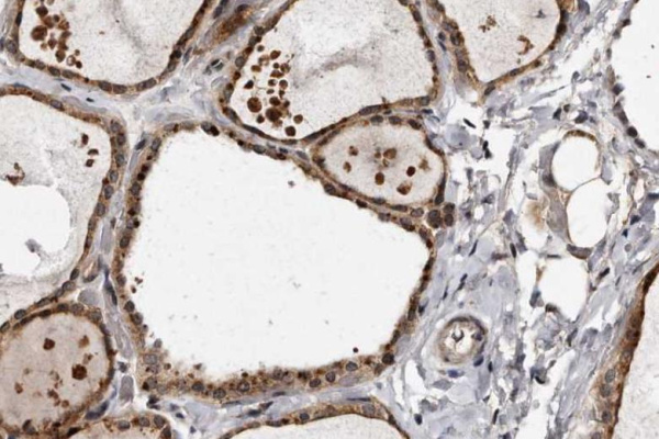 TSH Monoclonal Antibody (ELAB6548-M)