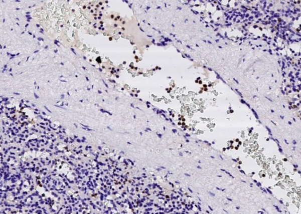 ficolin 1/FCN1/FCNA Monoclonal Antibody (AN200112P)