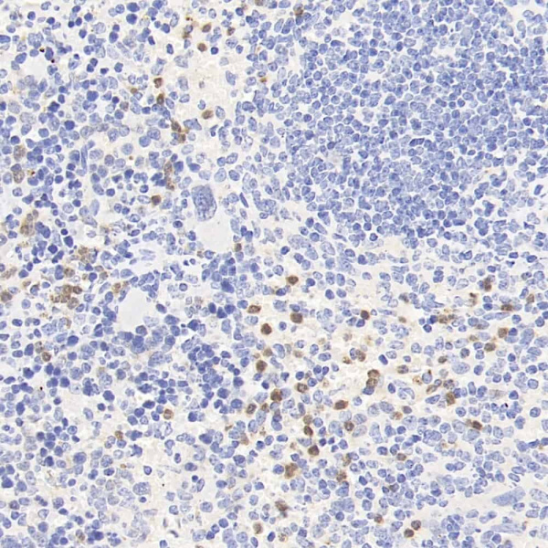 CCR5 Polyclonal Antibody (E-AB-70361)