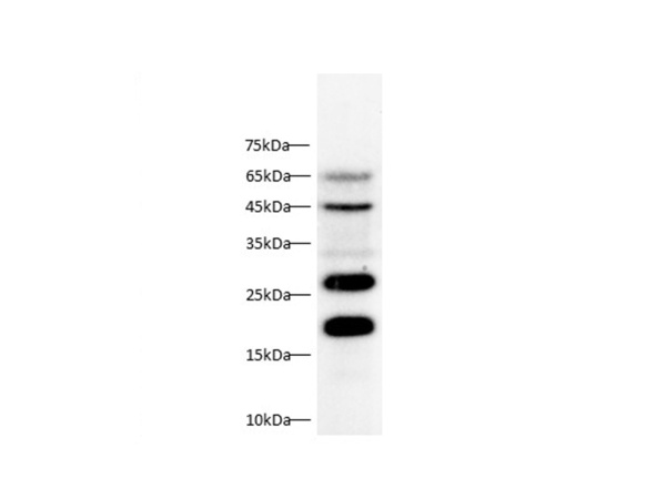 CTSB Polyclonal Antibody (D-AB-10435L)