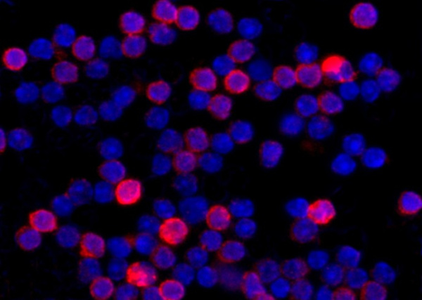 Recombinant CD95/APO-1/TNFRSF6/FAS Monoclonal Antibody (AN300460P)
