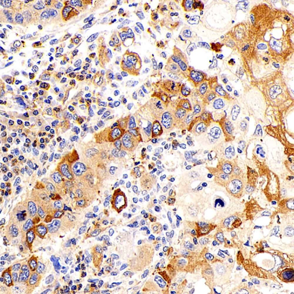 UCP2 Polyclonal Antibody (E-AB-70257)