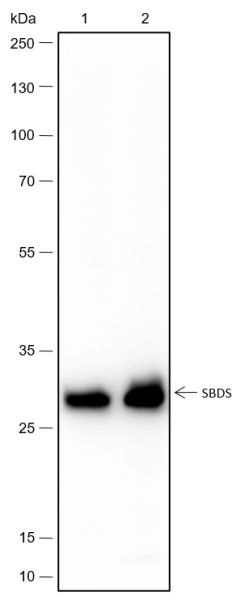 Recombinant SBDS Monoclonal Antibody (AN301724L)