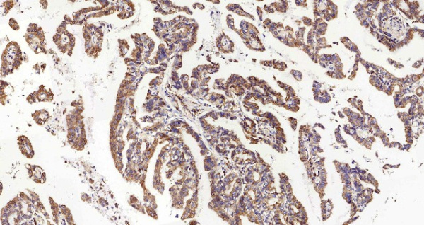 HSPA5 Polyclonal Antibody (E-AB-70041)