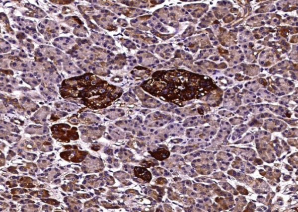 Recombinant Clusterin/Apolipoprotein J/Apo-J/CLU Monoclonal Antibody (AN300046P)