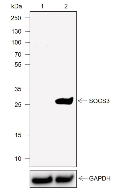Recombinant SOCS3 Monoclonal Antibody (AN302003L)