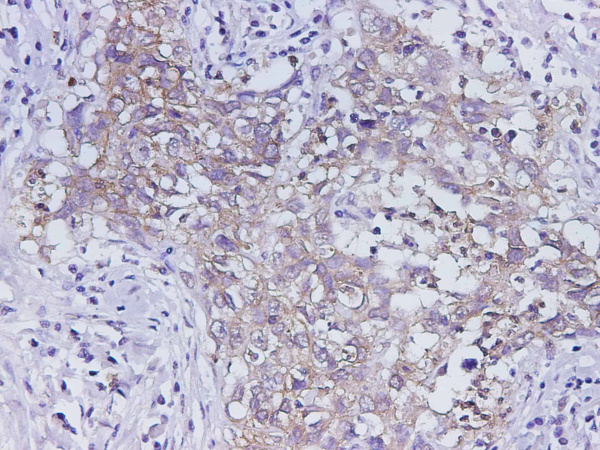 EpCAM Polyclonal Antibody (D-AB-10365L)