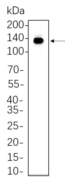 Recombinant CD117/c-Kit Monoclonal Antibody (AN301303L)