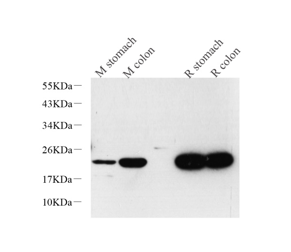 TAGLN Polyclonal Antibody (E-AB-70234)