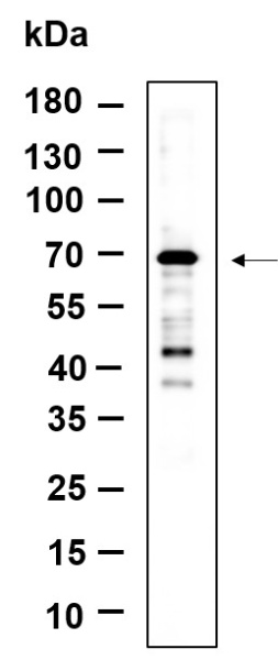 Recombinant NF2 Monoclonal Antibody (AN301159L)