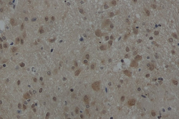 AKT1 Polyclonal Antibody (E-AB-40032)
