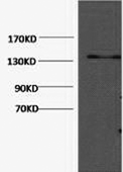 COL3A1 Monoclonal Antibody (E-AB-22071)